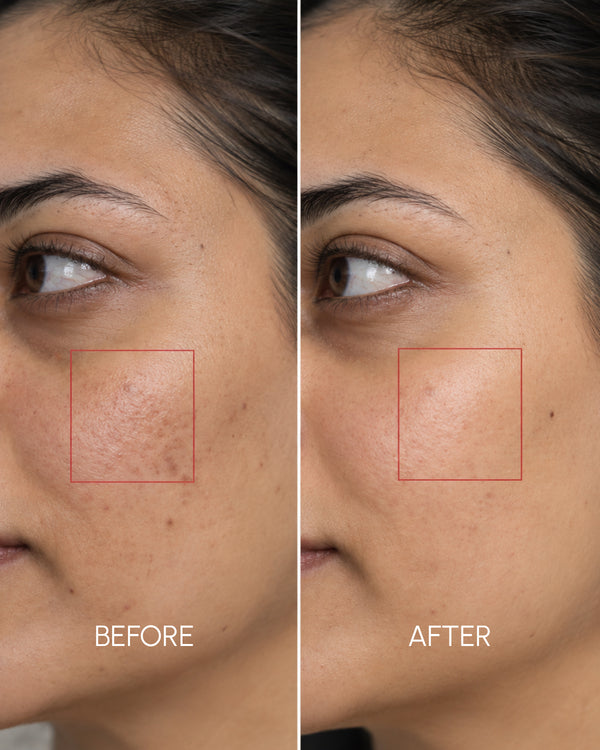 Amulya Kumkumadi Tailam – Intensive Skin Nourishment Face Oil 10ml (For brighter, smoother, more even-looking skin)