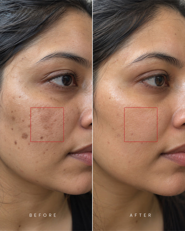 Amulya Kumkumadi Night Face Cream – Intensive Skin Nourishment 15g (Deep hydration for brighter, smoother-looking skin)